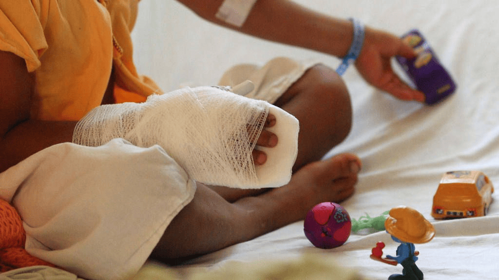 ¡Lamentable! Cifra de niños quemados por pólvora asciende a 27 en lo que va de la temporada navideña en Honduras