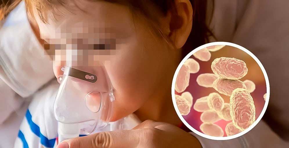 Casos de tosferina en Honduras van en aumento: se reportan 81